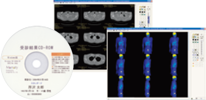 受診結果　CD-ROM　無料