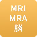 MRI MRA 脳