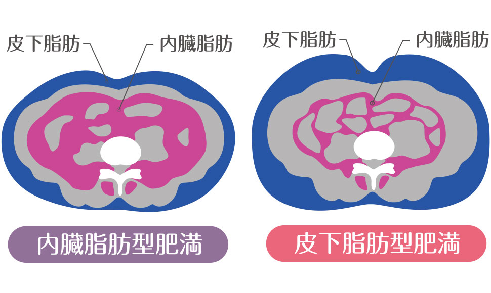 内臓脂肪計測